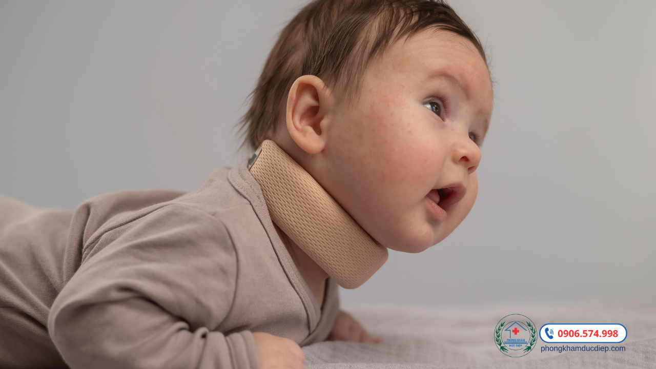 Vật lý trị liệu cho trẻ vẹo cổ